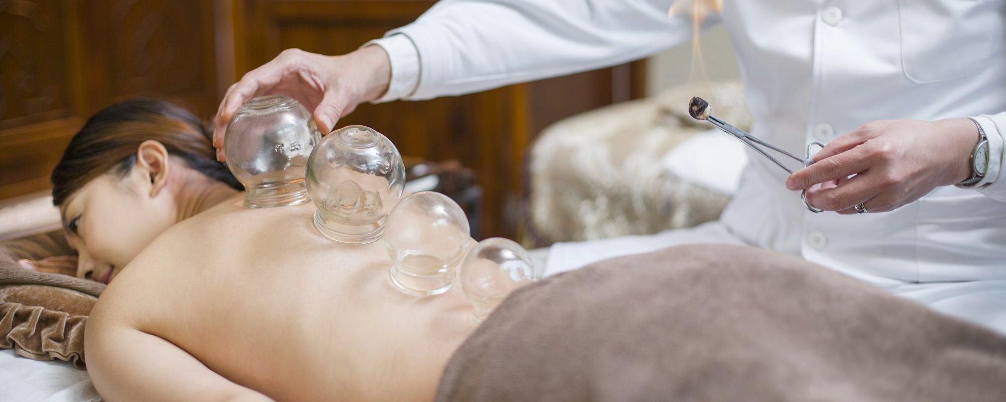 Young woman receiving vacuum cupping treatment